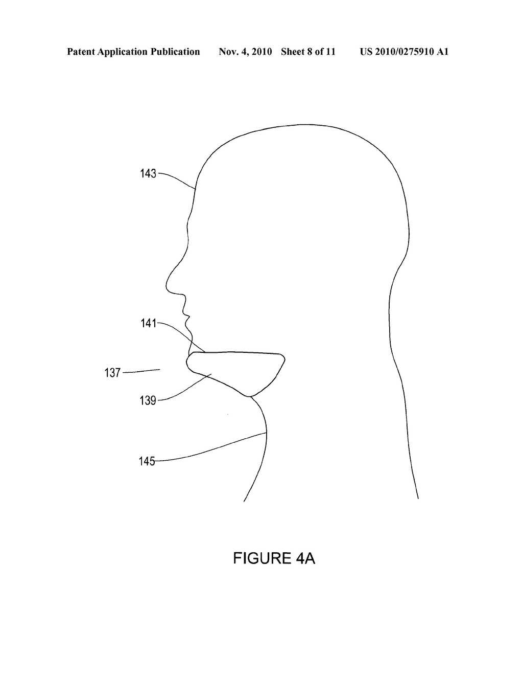 DEVICE AND METHOD FOR OPENING AN AIRWAY - diagram, schematic, and image 09