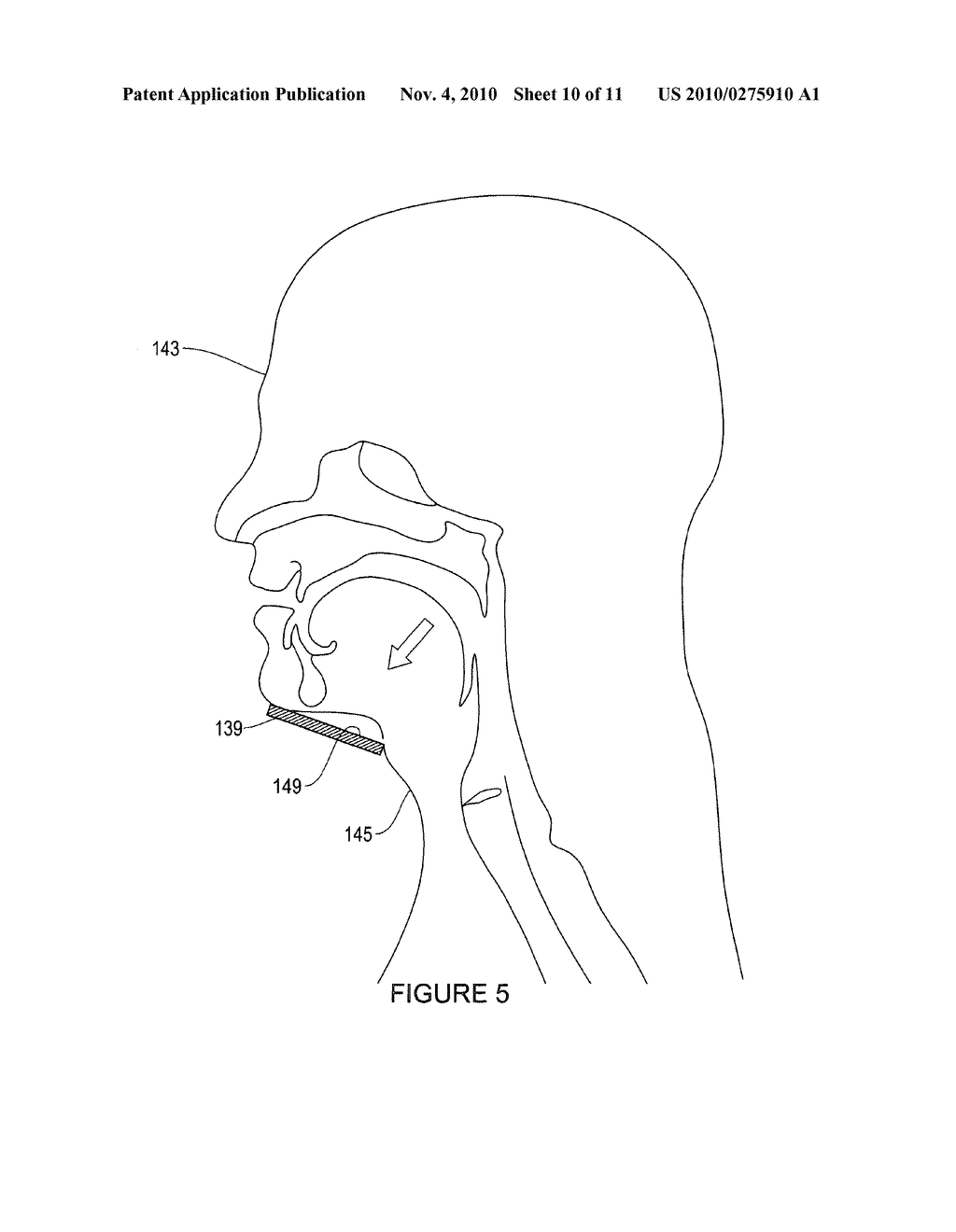 DEVICE AND METHOD FOR OPENING AN AIRWAY - diagram, schematic, and image 11