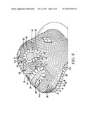 RADIATION THERAPY MASK TAPE AND RELATED METHOD diagram and image