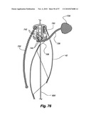 RETRACTABLE SHADE FOR COVERINGS FOR ARCHITECTURAL OPENINGS diagram and image