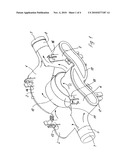 SENSOR MECHANISM AND METHOD FOR THE PRODUCTION THEREOF diagram and image