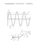 Apparatus for Respiration State Gated Brachytherapy diagram and image