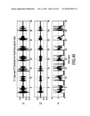 Wind Suppression/Replacement Component for use with Electronic Systems diagram and image