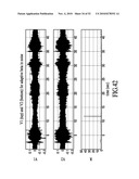 Wind Suppression/Replacement Component for use with Electronic Systems diagram and image