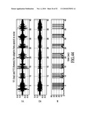 Wind Suppression/Replacement Component for use with Electronic Systems diagram and image