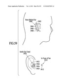 Wind Suppression/Replacement Component for use with Electronic Systems diagram and image