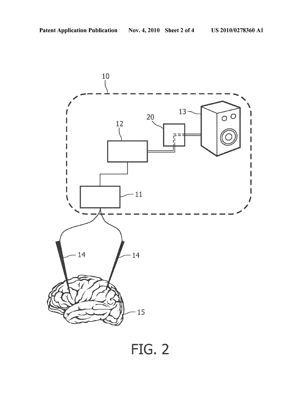 METHOD AND SUPPORT SYSTEM FOR PRESENTING ELECTROPHYSIOLOGICAL MEASUREMENTS - diagram, schematic, and image 03