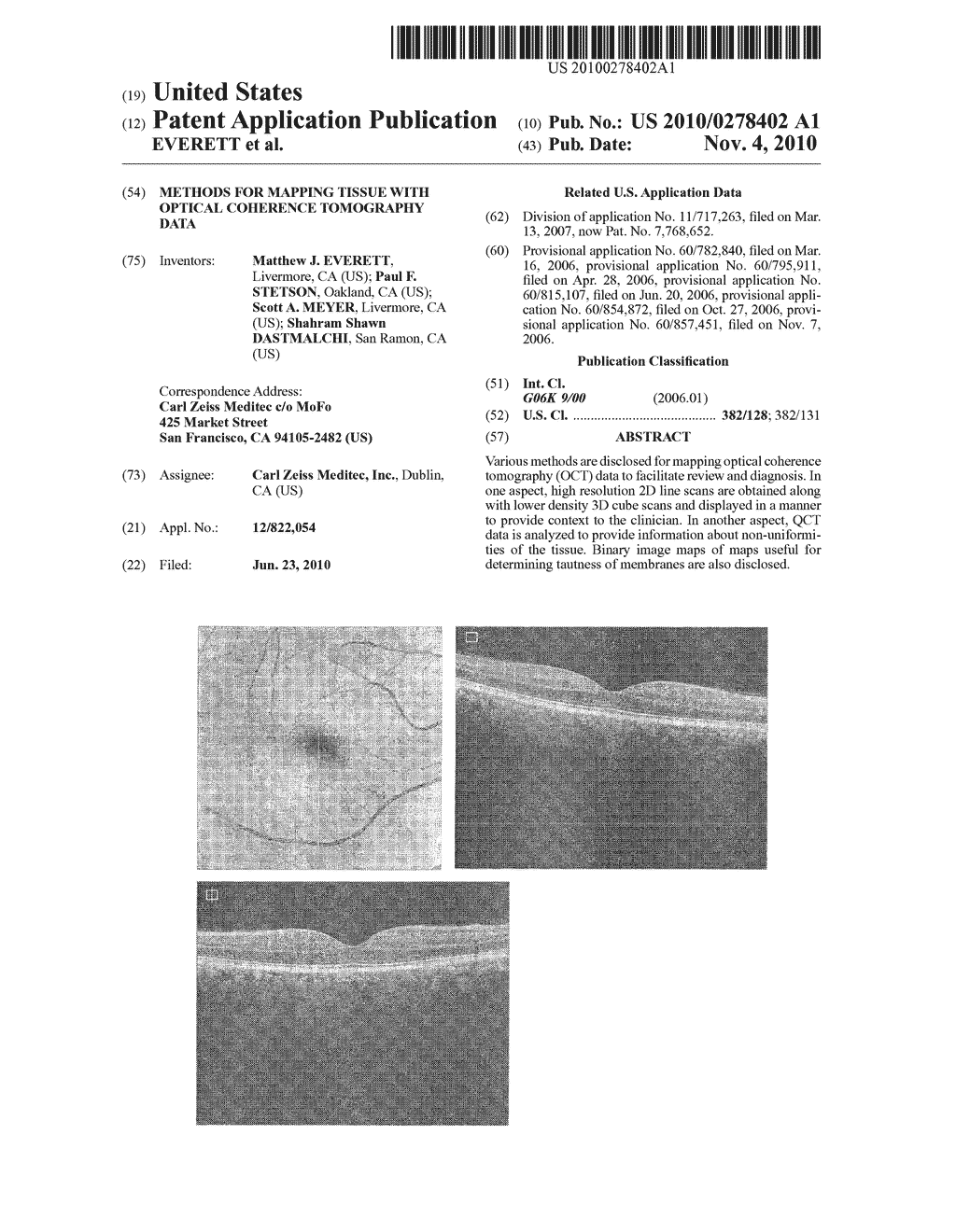 METHODS FOR MAPPING TISSUE WITH OPTICAL COHERENCE TOMOGRAPHY DATA - diagram, schematic, and image 01