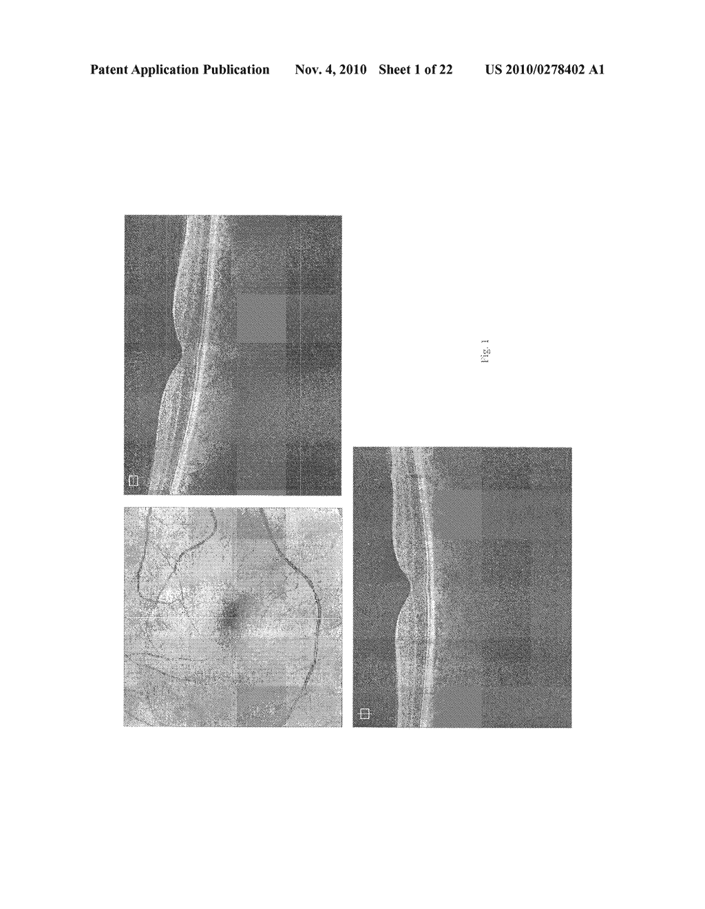 METHODS FOR MAPPING TISSUE WITH OPTICAL COHERENCE TOMOGRAPHY DATA - diagram, schematic, and image 02