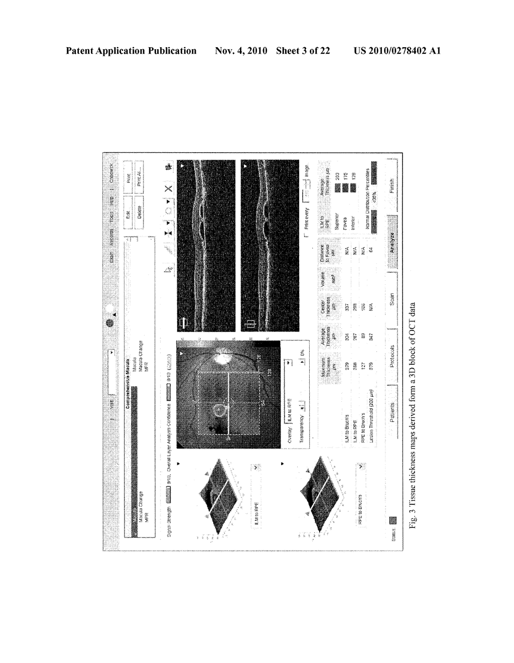 METHODS FOR MAPPING TISSUE WITH OPTICAL COHERENCE TOMOGRAPHY DATA - diagram, schematic, and image 04