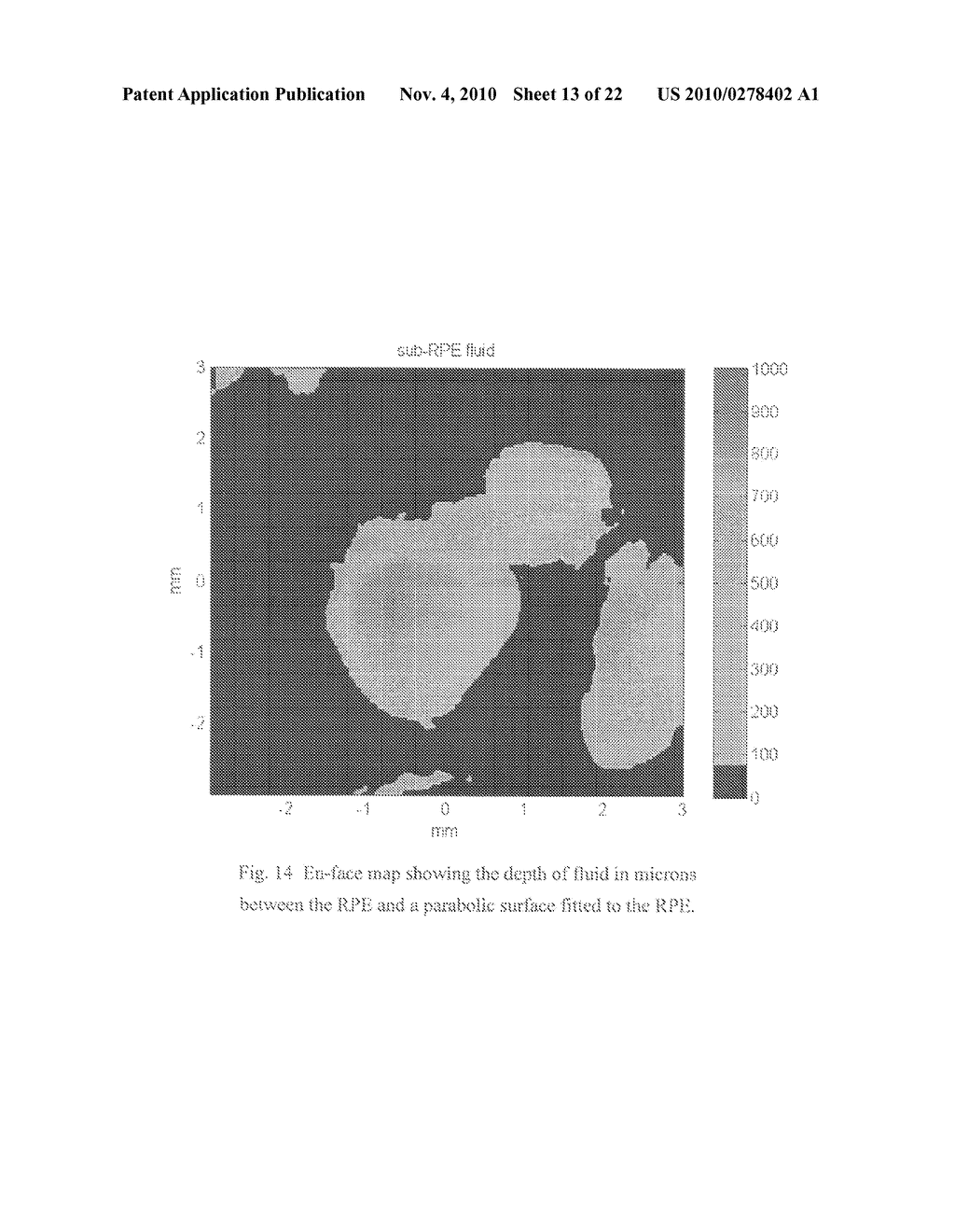 METHODS FOR MAPPING TISSUE WITH OPTICAL COHERENCE TOMOGRAPHY DATA - diagram, schematic, and image 14