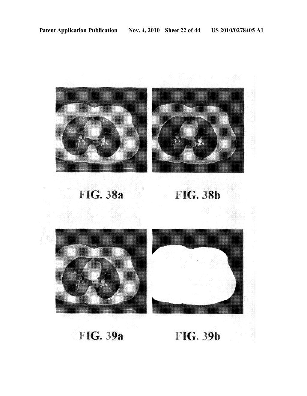 Scoring Method for Imaging-Based Detection of Vulnerable Patients - diagram, schematic, and image 23