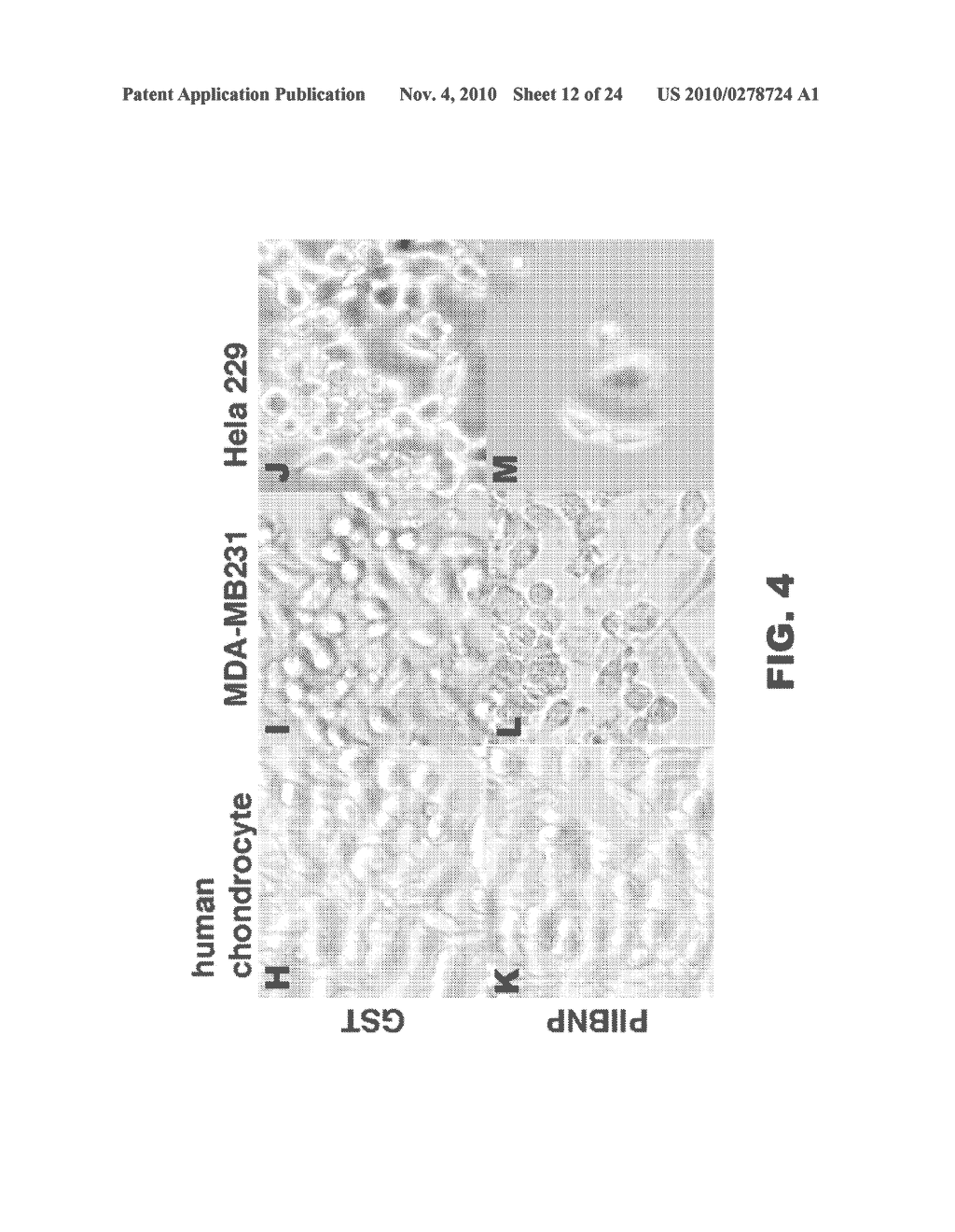 INHIBITION OF MIGRATION AND INDUCTION OF CELL DEATH BY THE TYPE II COLLAGEN AMINO PROPEPTIDES - diagram, schematic, and image 13