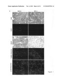 Novel compositions including sphingosine kinase type 1 inhibitors, and processes for using same diagram and image