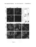 Novel compositions including sphingosine kinase type 1 inhibitors, and processes for using same diagram and image