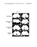 Composition Containing Arazyme for the Prevention and Treatment of Arthritis diagram and image