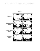 Composition Containing Arazyme for the Prevention and Treatment of Arthritis diagram and image