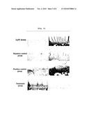 Composition Containing Arazyme for the Prevention and Treatment of Arthritis diagram and image