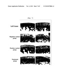 Composition Containing Arazyme for the Prevention and Treatment of Arthritis diagram and image