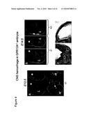 Methods of Modulating Angiogenesis diagram and image