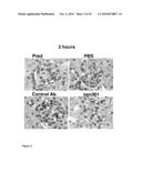 COMPOUNDS AND METHODS FOR THE TREATMENT OF RENAL DISEASE diagram and image