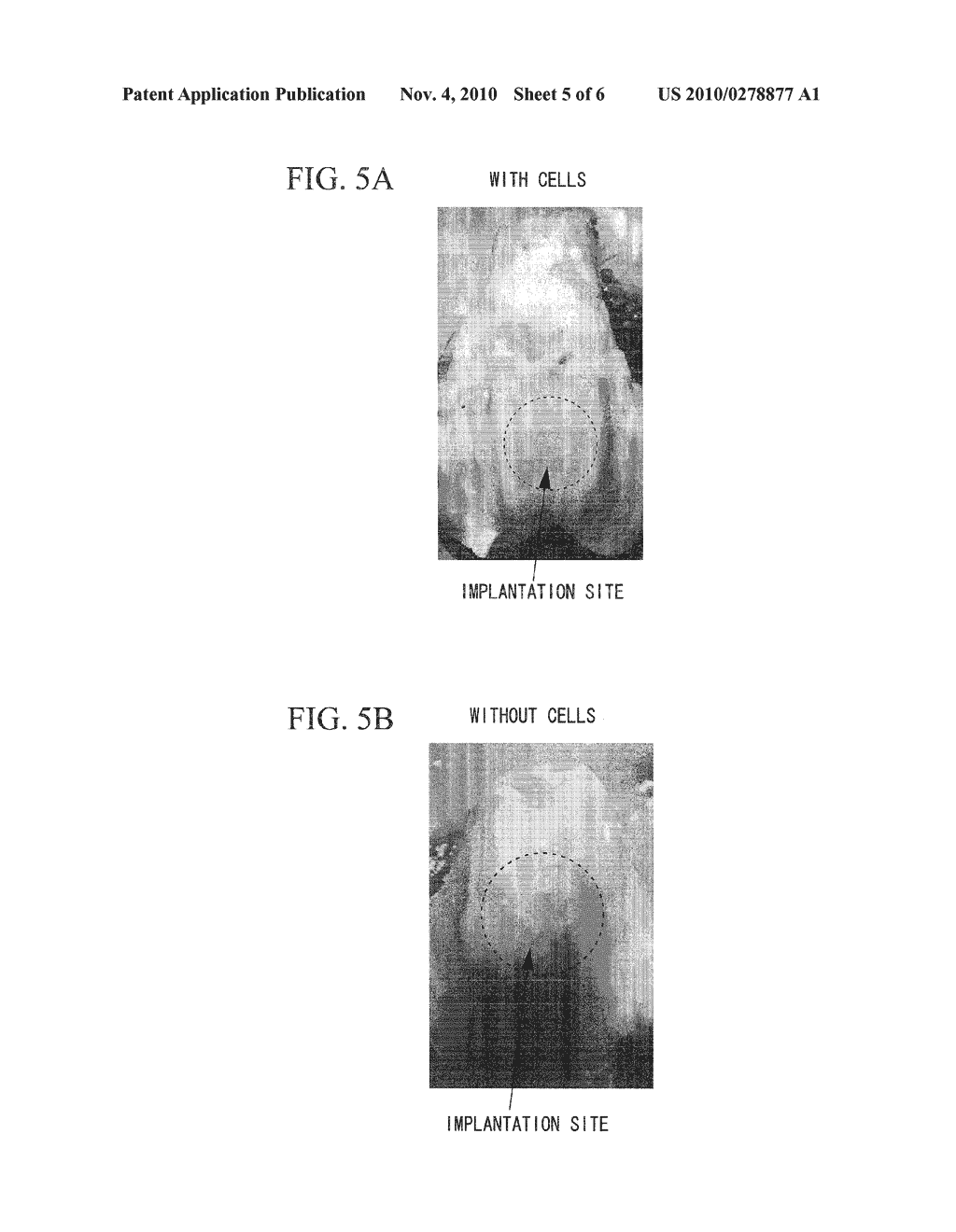 BODY TISSUE FILLING MATERIAL AND METHOD FOR PRODUCTION THEREOF - diagram, schematic, and image 06