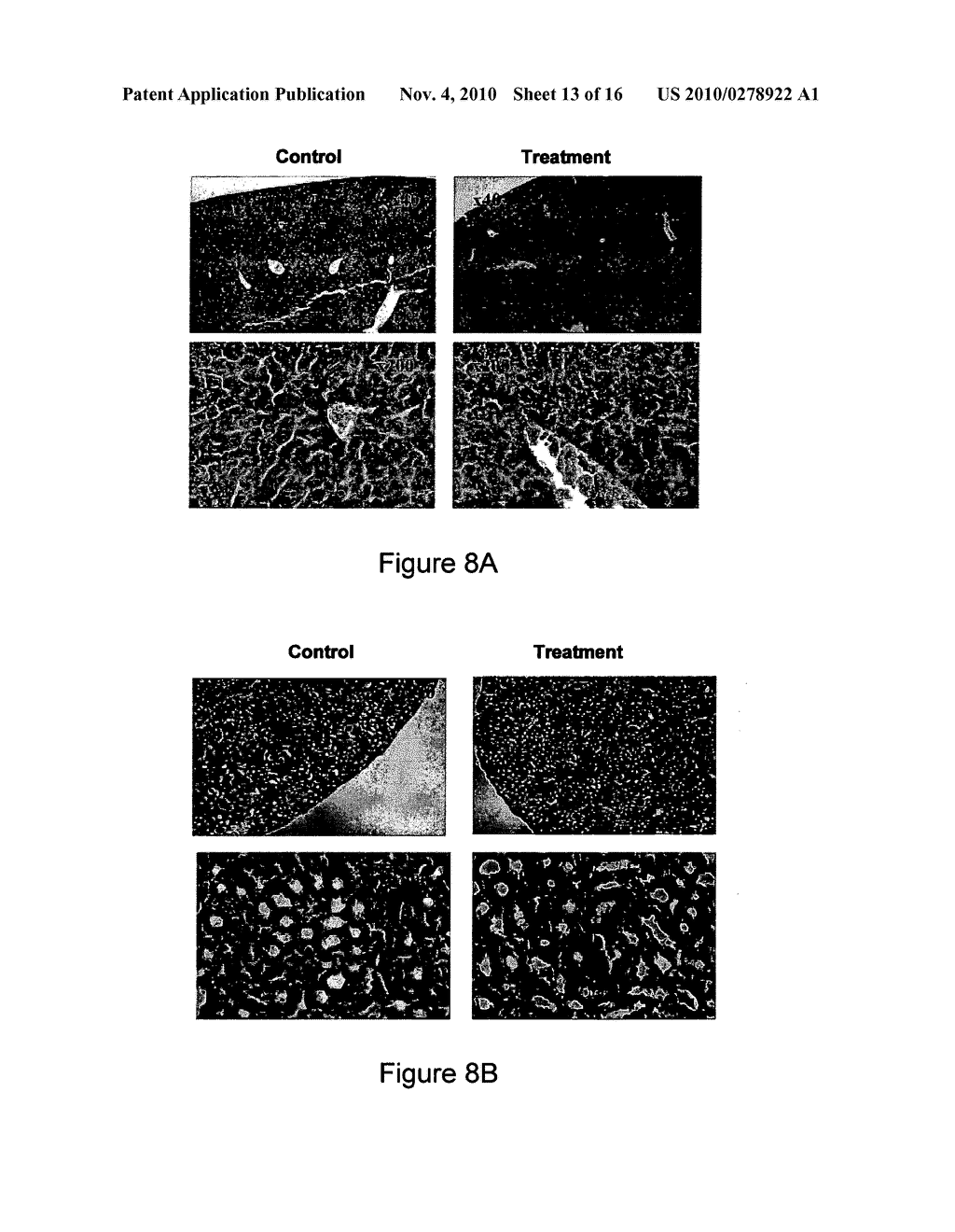 METHODS AND COMPOSITIONS FOR ORAL ADMINISTRATION OF INSULIN - diagram, schematic, and image 14