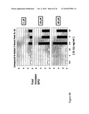 Enhanced erythropoiesis and iron metabolism diagram and image