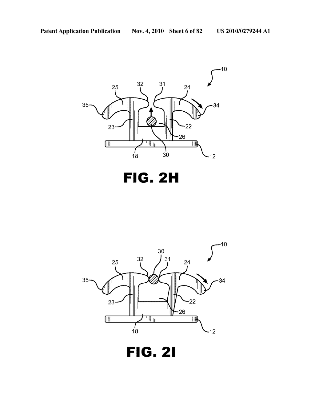 METHOD OF REMOVING AN ARCHWIRE FROM AN ORTHODONTIC BRACKET AND WIRE DISENGAGEMENT INSTRUMENTS FOR APPLYING SUCH METHOD - diagram, schematic, and image 07