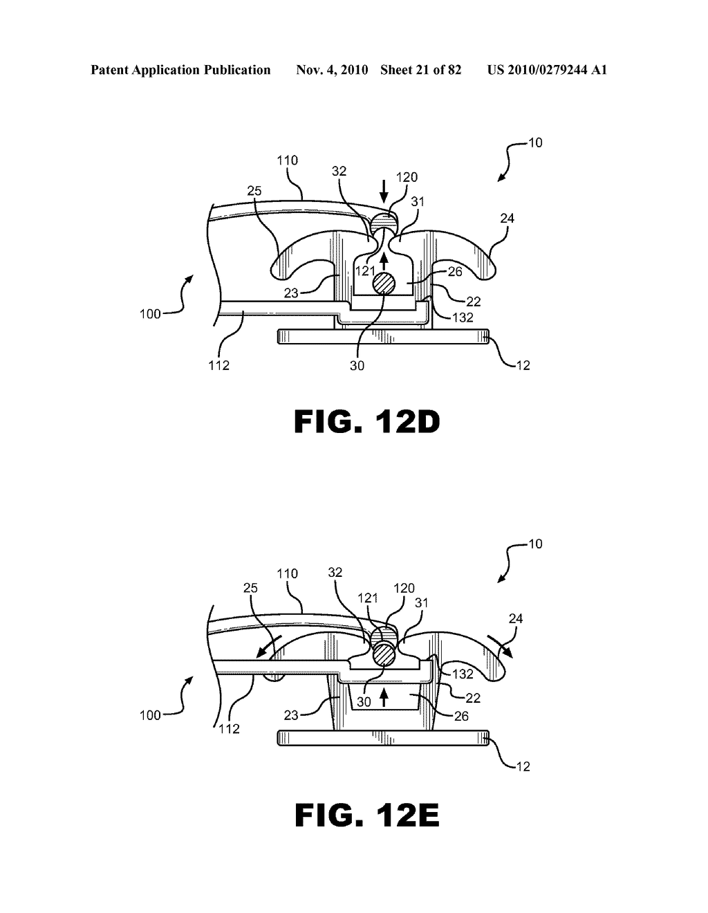 METHOD OF REMOVING AN ARCHWIRE FROM AN ORTHODONTIC BRACKET AND WIRE DISENGAGEMENT INSTRUMENTS FOR APPLYING SUCH METHOD - diagram, schematic, and image 22