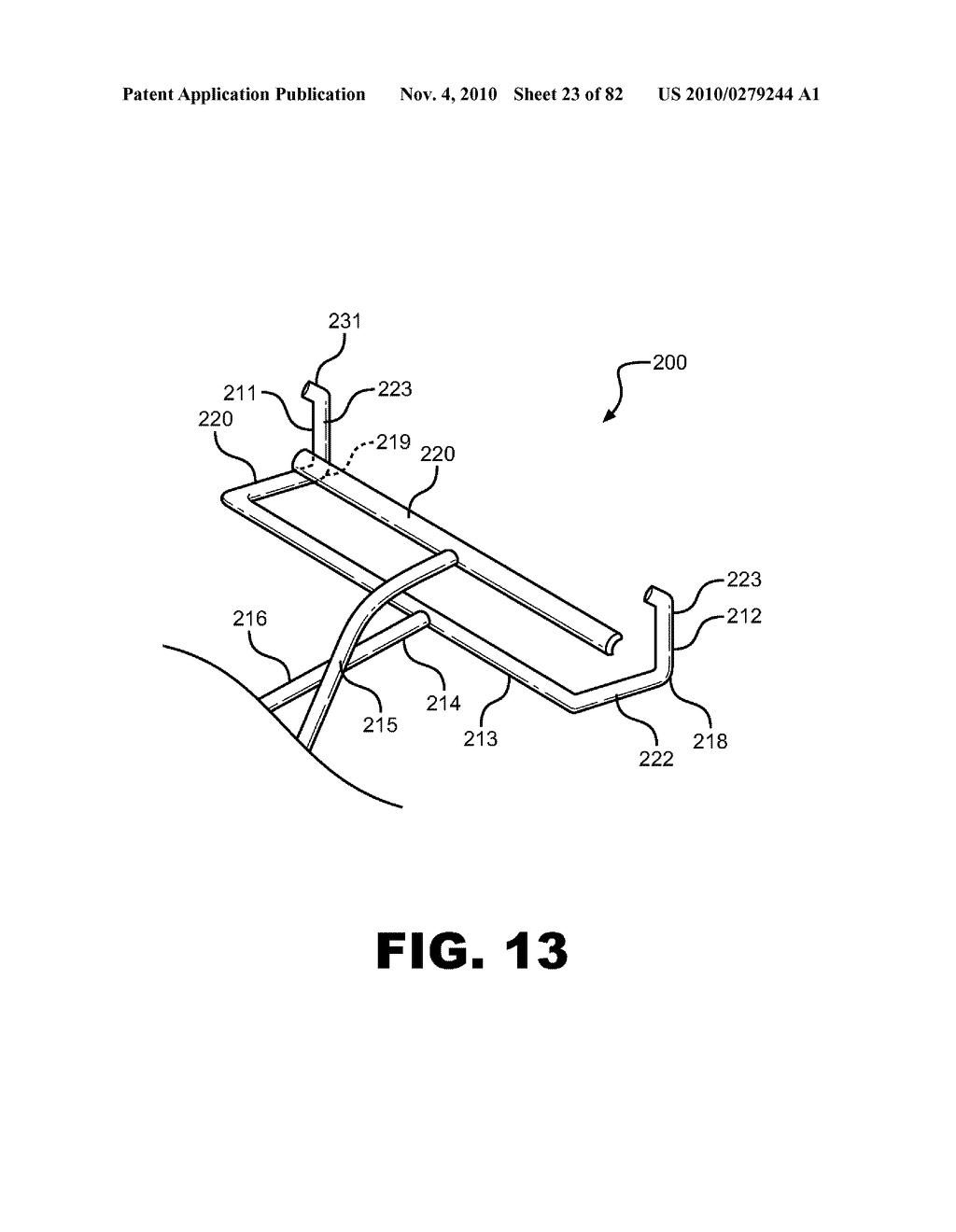 METHOD OF REMOVING AN ARCHWIRE FROM AN ORTHODONTIC BRACKET AND WIRE DISENGAGEMENT INSTRUMENTS FOR APPLYING SUCH METHOD - diagram, schematic, and image 24