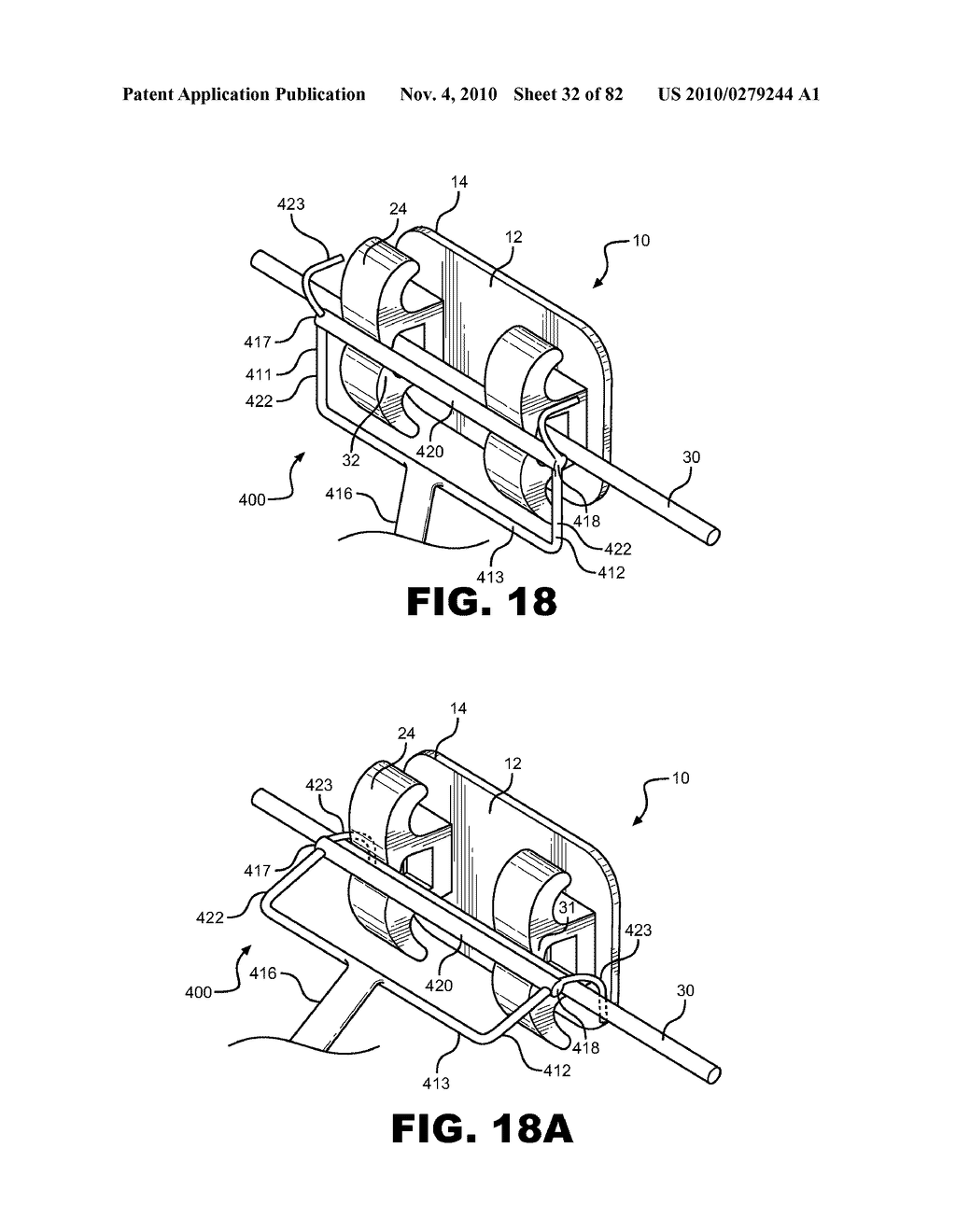 METHOD OF REMOVING AN ARCHWIRE FROM AN ORTHODONTIC BRACKET AND WIRE DISENGAGEMENT INSTRUMENTS FOR APPLYING SUCH METHOD - diagram, schematic, and image 33