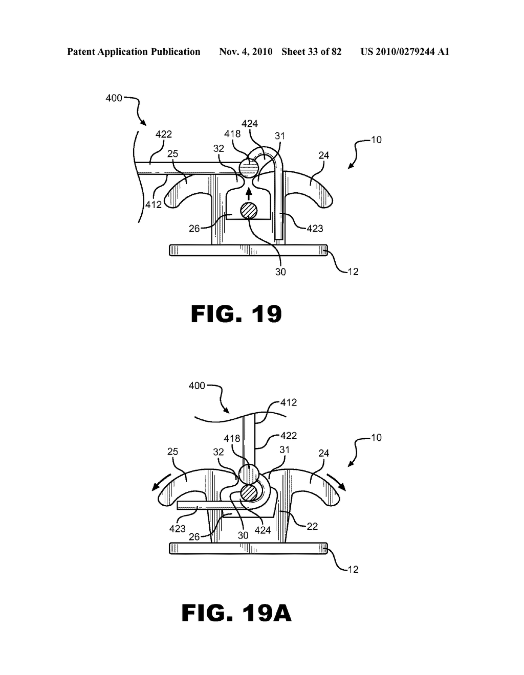 METHOD OF REMOVING AN ARCHWIRE FROM AN ORTHODONTIC BRACKET AND WIRE DISENGAGEMENT INSTRUMENTS FOR APPLYING SUCH METHOD - diagram, schematic, and image 34