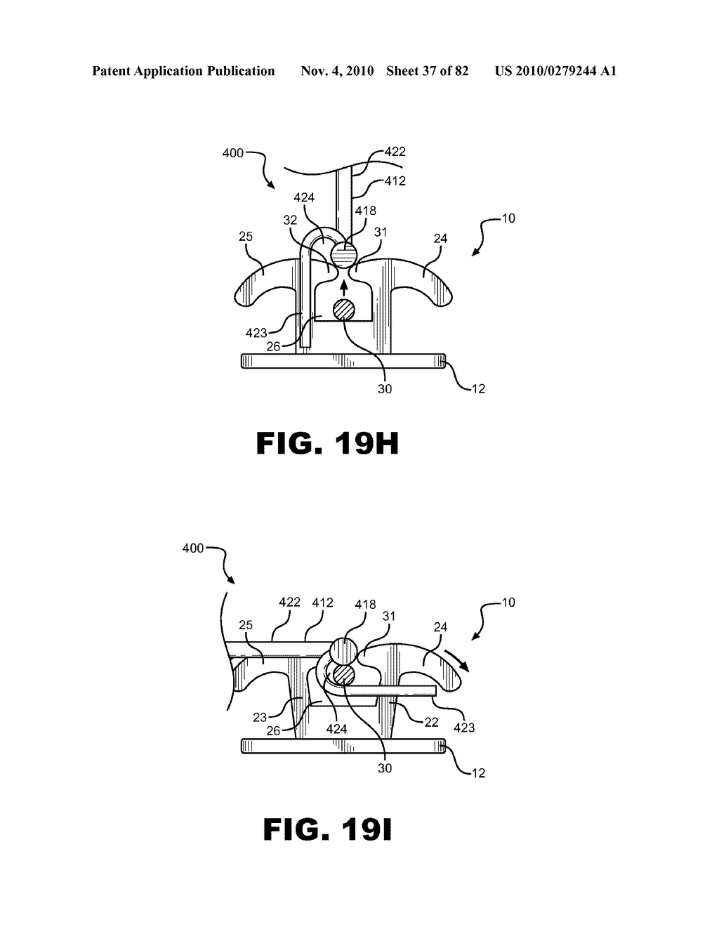 METHOD OF REMOVING AN ARCHWIRE FROM AN ORTHODONTIC BRACKET AND WIRE DISENGAGEMENT INSTRUMENTS FOR APPLYING SUCH METHOD - diagram, schematic, and image 38