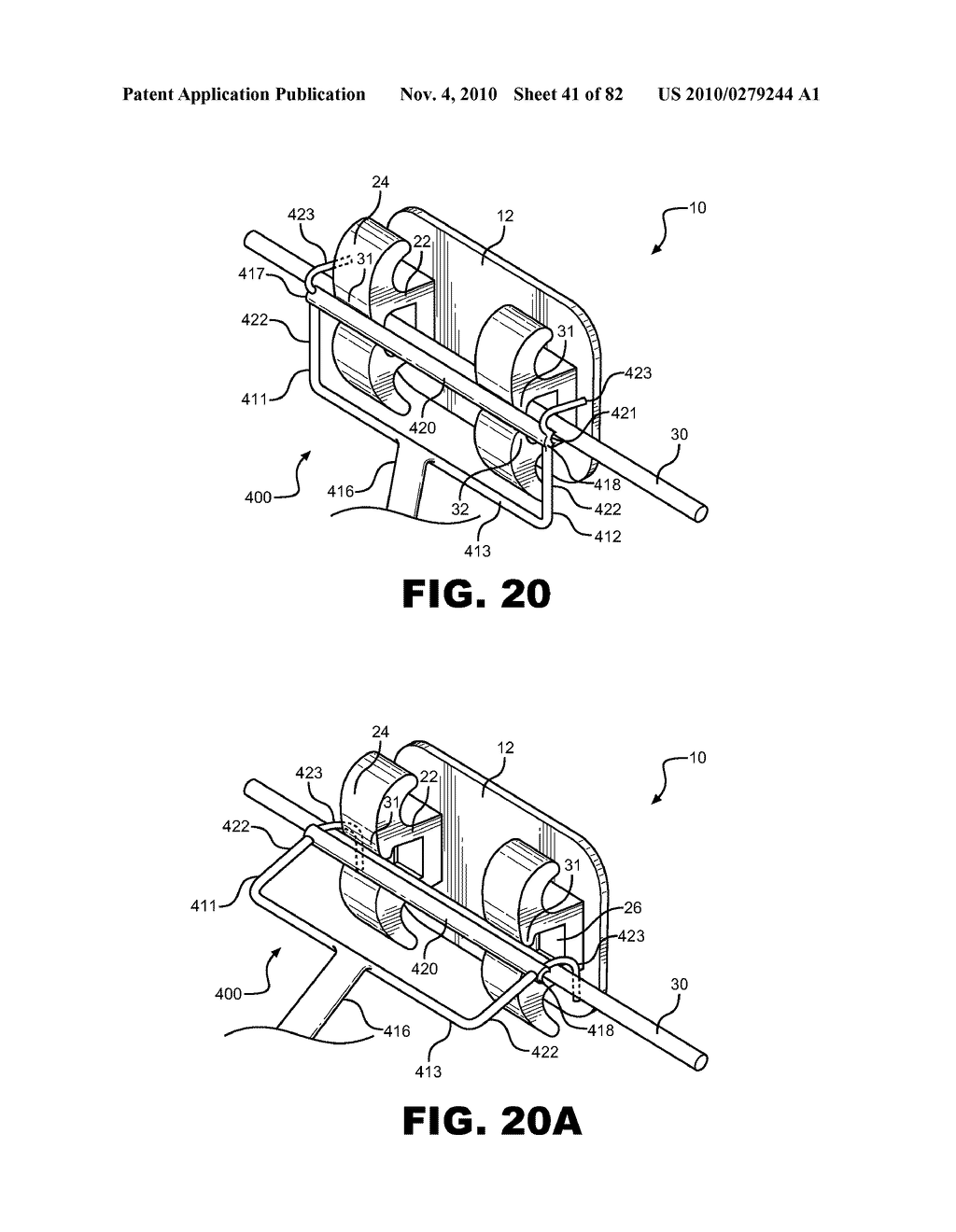 METHOD OF REMOVING AN ARCHWIRE FROM AN ORTHODONTIC BRACKET AND WIRE DISENGAGEMENT INSTRUMENTS FOR APPLYING SUCH METHOD - diagram, schematic, and image 42