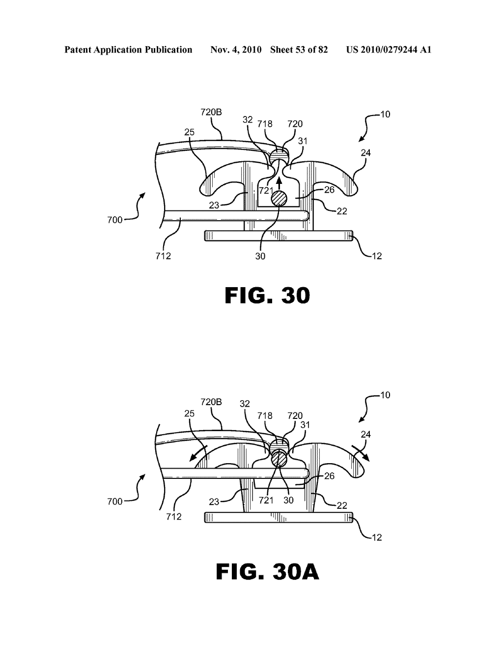 METHOD OF REMOVING AN ARCHWIRE FROM AN ORTHODONTIC BRACKET AND WIRE DISENGAGEMENT INSTRUMENTS FOR APPLYING SUCH METHOD - diagram, schematic, and image 54