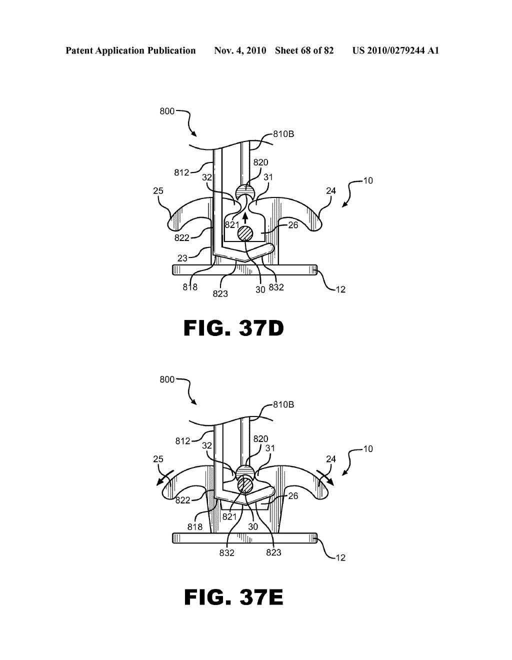 METHOD OF REMOVING AN ARCHWIRE FROM AN ORTHODONTIC BRACKET AND WIRE DISENGAGEMENT INSTRUMENTS FOR APPLYING SUCH METHOD - diagram, schematic, and image 69