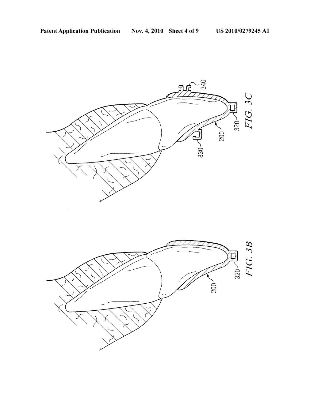 Removable Orthodontic Appliance and Method of Forming the Same - diagram, schematic, and image 05