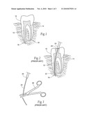 Flexible needle housing diagram and image