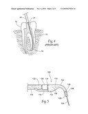 Flexible needle housing diagram and image