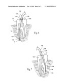 Flexible needle housing diagram and image