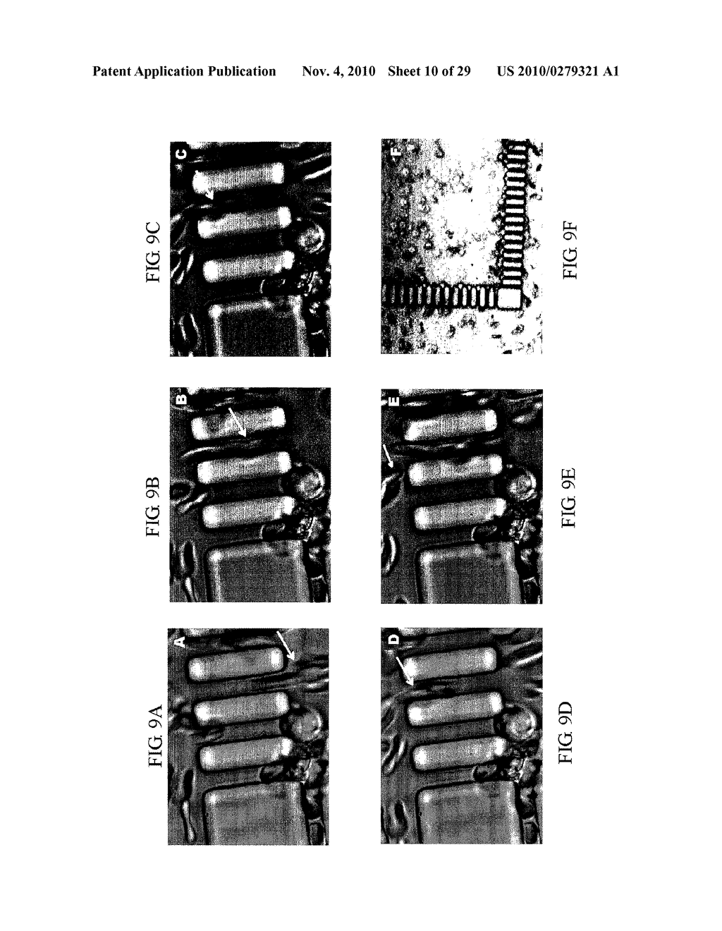 METHODS AND APPARATUS FOR THE ISOLATION AND ENRICHMENT OF CIRCULATING TUMOR CELLS - diagram, schematic, and image 11