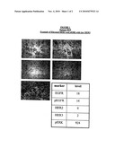 METHOD FOR PREDICTING RESPONSE TO EPIDERMAL GROWTH FACTOR RECEPTOR-DIRECTED THERAPY diagram and image