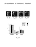 CD36 MODULATION AND USES THEREOF diagram and image