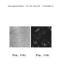 RHOKINASE-DEPENDENT INHIBITION ACTIVITY ON PULMONARY ARTERY ENDOTHELIUM DYSFUNCTION, MEDIAL WALL THICKNESS AND VASCULAR OBSTRUCTION OF PULMODIL AND PULMODIL-1 diagram and image