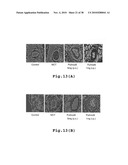 RHOKINASE-DEPENDENT INHIBITION ACTIVITY ON PULMONARY ARTERY ENDOTHELIUM DYSFUNCTION, MEDIAL WALL THICKNESS AND VASCULAR OBSTRUCTION OF PULMODIL AND PULMODIL-1 diagram and image