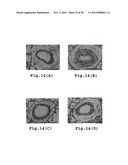 RHOKINASE-DEPENDENT INHIBITION ACTIVITY ON PULMONARY ARTERY ENDOTHELIUM DYSFUNCTION, MEDIAL WALL THICKNESS AND VASCULAR OBSTRUCTION OF PULMODIL AND PULMODIL-1 diagram and image