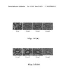 RHOKINASE-DEPENDENT INHIBITION ACTIVITY ON PULMONARY ARTERY ENDOTHELIUM DYSFUNCTION, MEDIAL WALL THICKNESS AND VASCULAR OBSTRUCTION OF PULMODIL AND PULMODIL-1 diagram and image