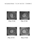 RHOKINASE-DEPENDENT INHIBITION ACTIVITY ON PULMONARY ARTERY ENDOTHELIUM DYSFUNCTION, MEDIAL WALL THICKNESS AND VASCULAR OBSTRUCTION OF PULMODIL AND PULMODIL-1 diagram and image