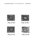 RHOKINASE-DEPENDENT INHIBITION ACTIVITY ON PULMONARY ARTERY ENDOTHELIUM DYSFUNCTION, MEDIAL WALL THICKNESS AND VASCULAR OBSTRUCTION OF PULMODIL AND PULMODIL-1 diagram and image